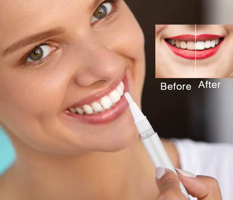 Glory -Smile Kit de Blanchiment Dentaire